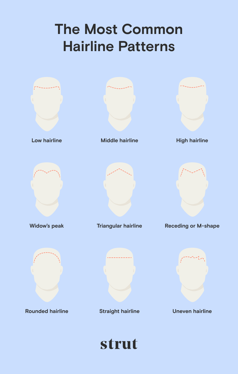 10 Common Types Of Hairlines In Men Women Strut Blog